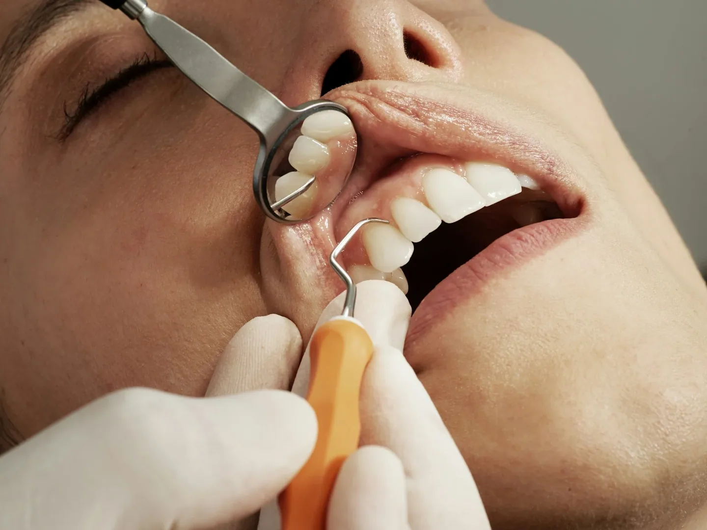 Nha khoa — Chuẩn bị trước cuộc hẹn